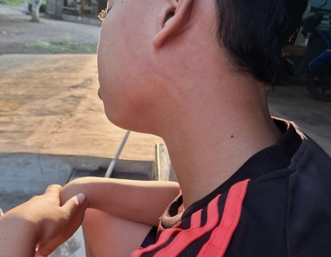 Ditampar Hingga Memar, Keluarga Siswa Yayasan  Al Hasani Kecam Lemahnya Sangsi Oknum Guru